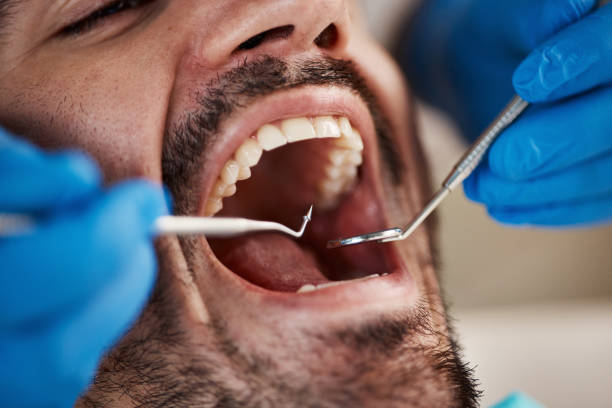 Best Emergency Treatment for Toothache in Lake Junaluska, NC
